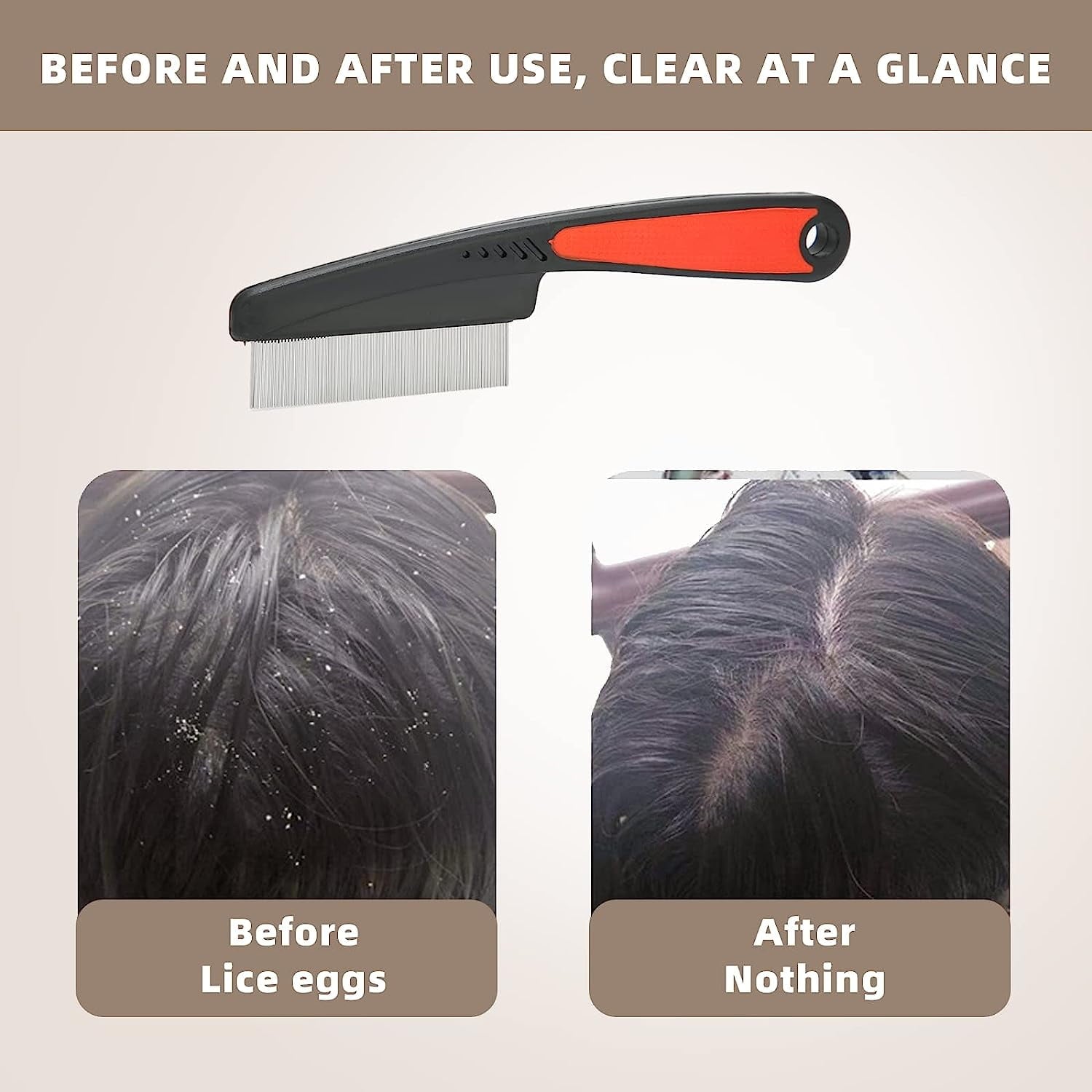Flea Comb, Dandruff Comb, Multifunction Stainless Steel Fine Tooth Comb Head Nit Removal Hair Comb Cat Dog Pet Grooming Scalp Flea Comb, Easy to Hold